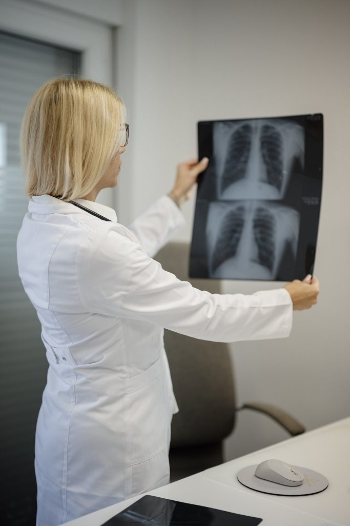 A doctor examining chest X-rays in a medical office